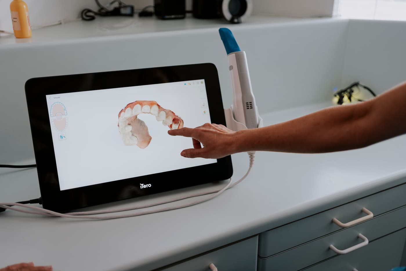 A digital smile scan on screen